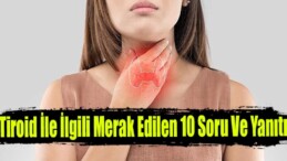 Tiroid ile İlgili Merak Edilen 10 Soru ve Yanıtı