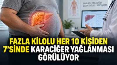 Fazla kilolu her 10 kişiden 7’sinde karaciğer yağlanması görülüyor